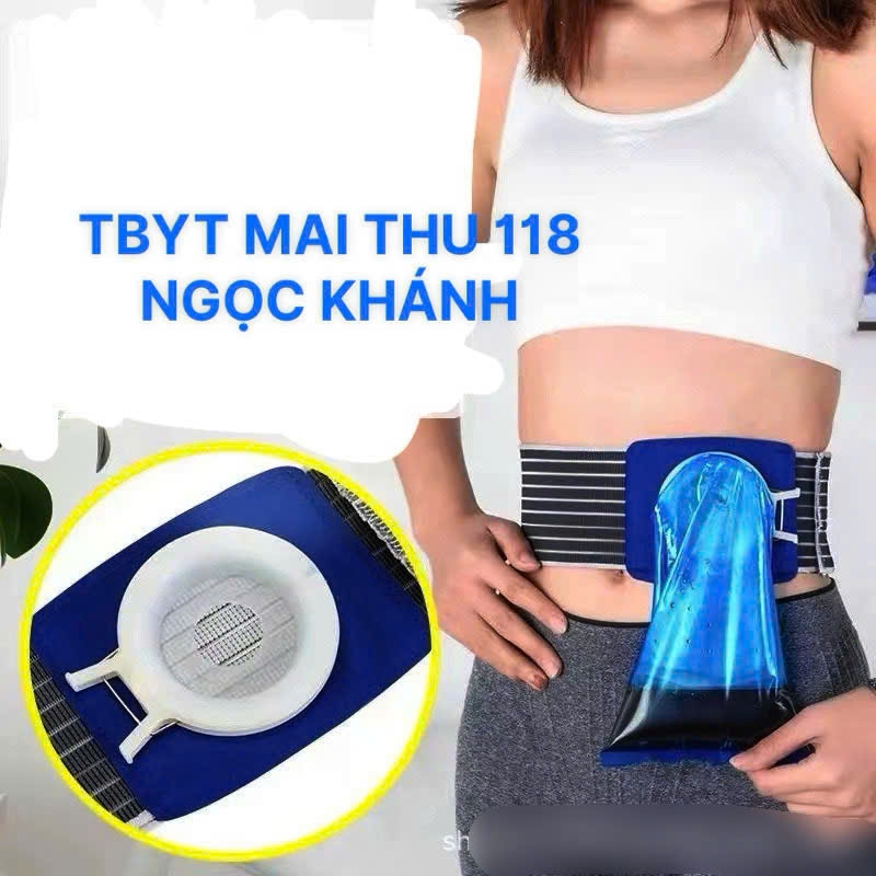 ĐAI ĐEO HẬU MÔN NHÂN TẠO